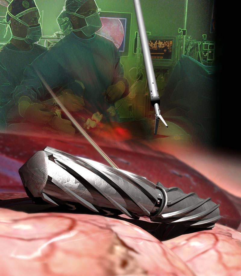 image from Surgical robots